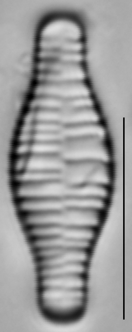 Fragilariforma bicapitata LM5