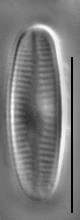 Achnanthidium kranzii LM1