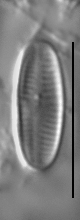 Achnanthidium kranzii LM4