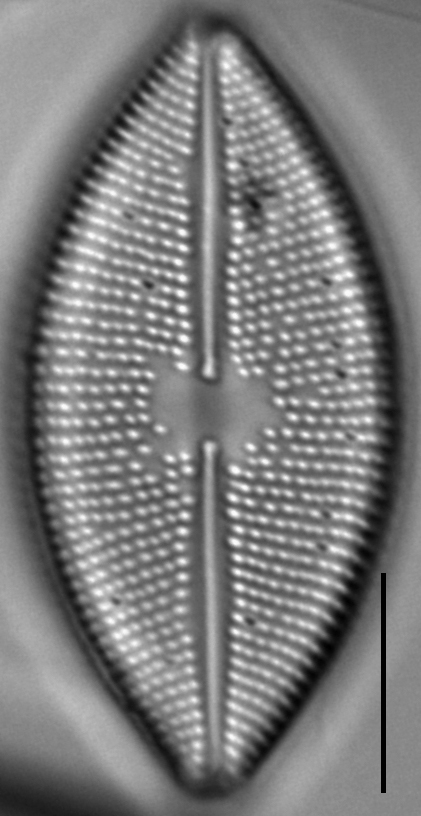 Lacustriella lacustris LM3