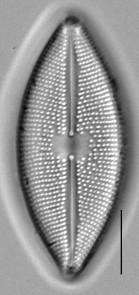 Lacustriella lacustris LM4