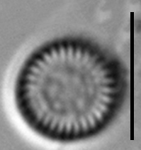 Lindavia comensis LM3