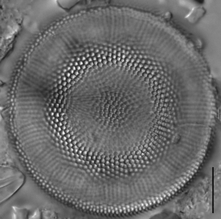 Actinocyclus normanii_LM3