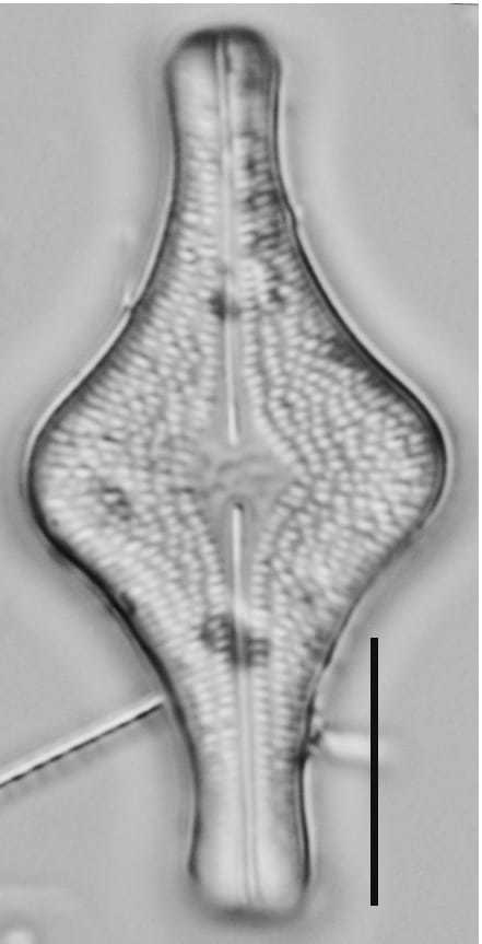 Brachysira follis LM1