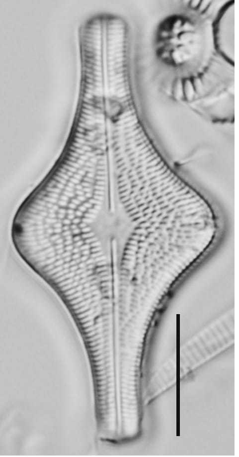 Brachysira follis LM7