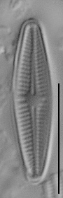 Achnanthidium eutrophilum LM2