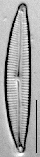 Encyonema evergladianum LM4