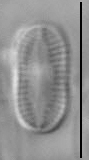 Psammothidium didymum LM2