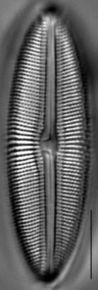 Muelleria spauldingiae LM5