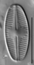 Psammothidium acidoclinatum LM4