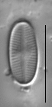 Psammothidium scoticum LM1