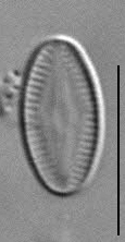 Psammothidium acidoclinatum LM1