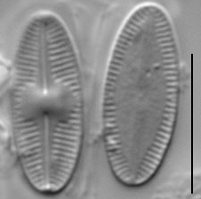 Psammothidium acidoclinatum LM5