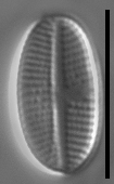 Psammothidium pennsylvanicum LM3