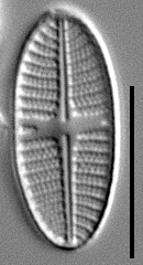 Platessa stewartii LM5