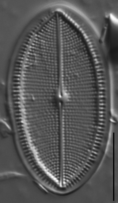 Cocconeis placentula LM1