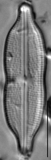 Neidiomorpha binodiformis LM5