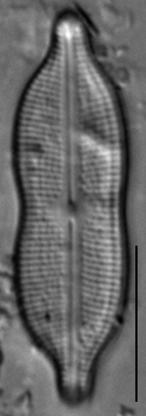 Neidiomorpha binodiformis LM4