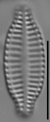 Karayevia ploenensis var gessneri LM2