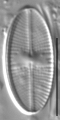 Karayevia oblongella LM7