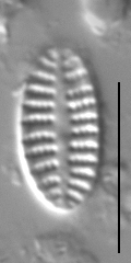 Karayevia oblongella LM6