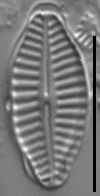 Karayevia ploenensis var gessneri LM5