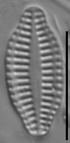 Karayevia ploenensis var gessneri LM4