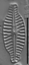 Karayevia ploenensis var gessneri LM3