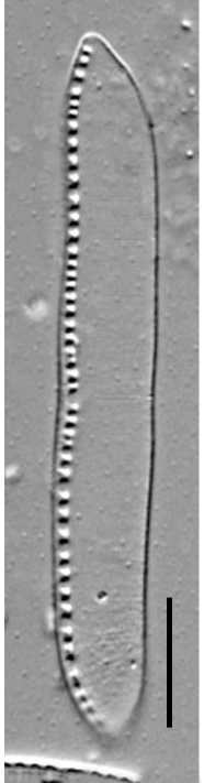 Nitzschia kurzeana LM5