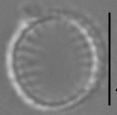 Nanofrustulum cataractarum LM3