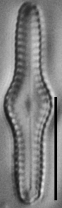 Ninastrelnikovia gibbosa LM4