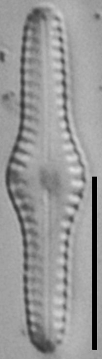 Ninastrelnikovia gibbosa LM3