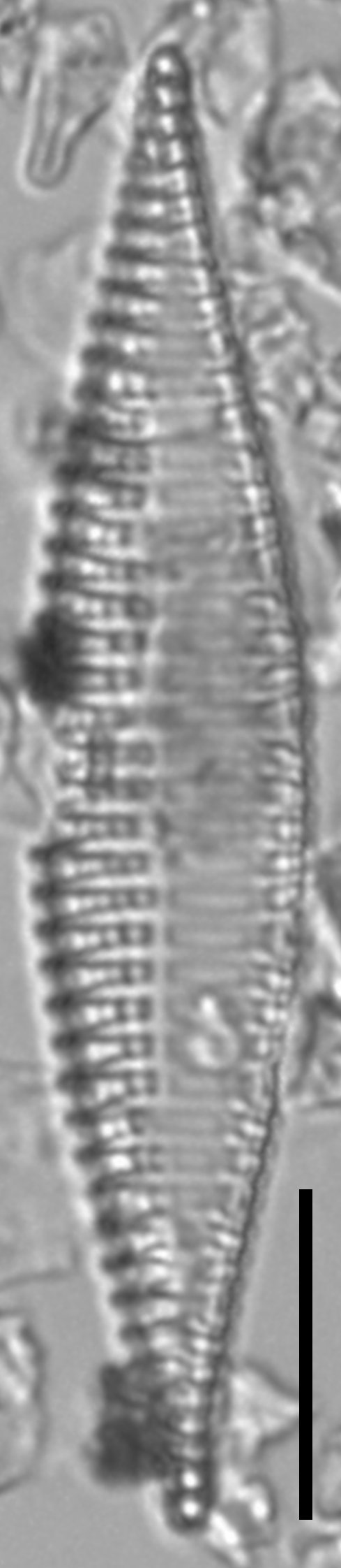 Tryblionella Lanceola LM4