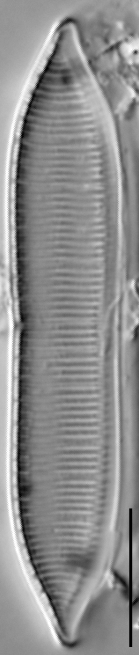 Tryblionella calida LM2