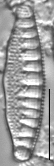 Nitzschia sinuata LM1