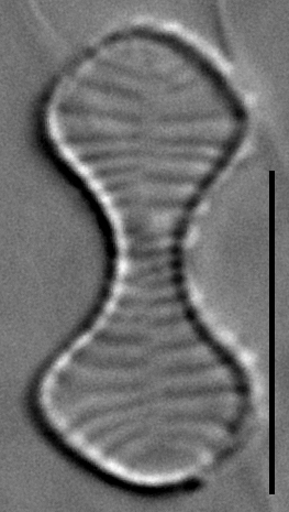 Oxyneis binalis LM5