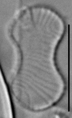 Oxyneis binalis LM3