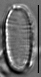 Oxyneis binalis var elliptica LM6