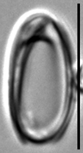 Oxyneis binalis var elliptica LM2