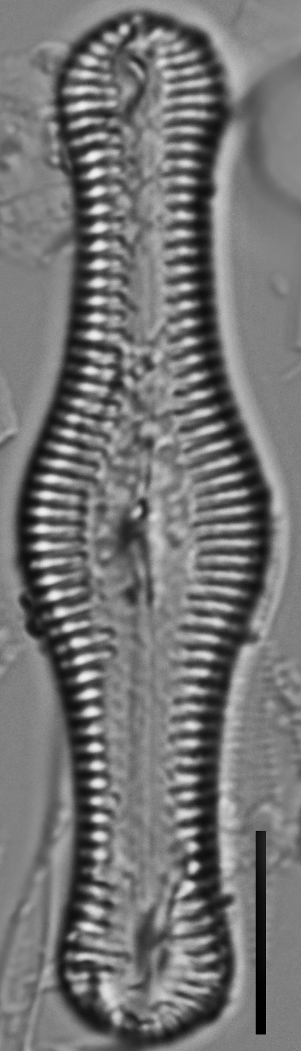 Pinnuaria turgidula LM1