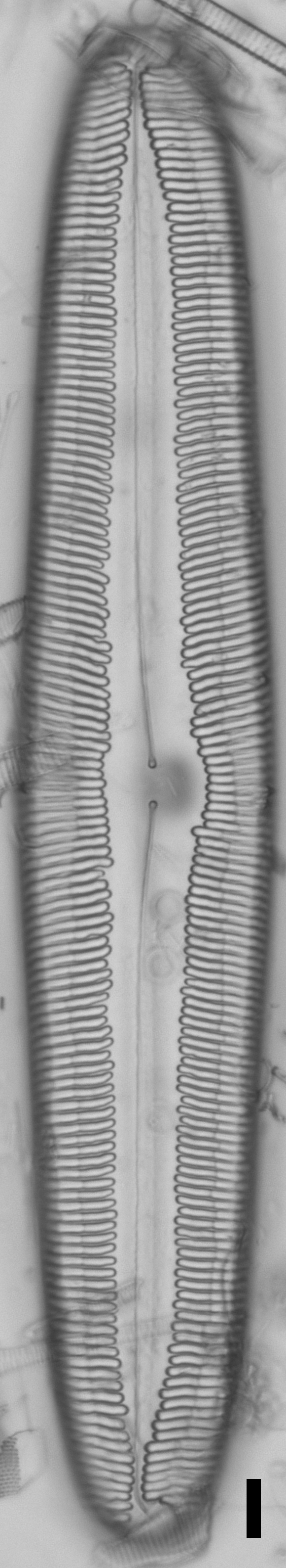 Pinnularia dariana ANSP NJSS0692 1