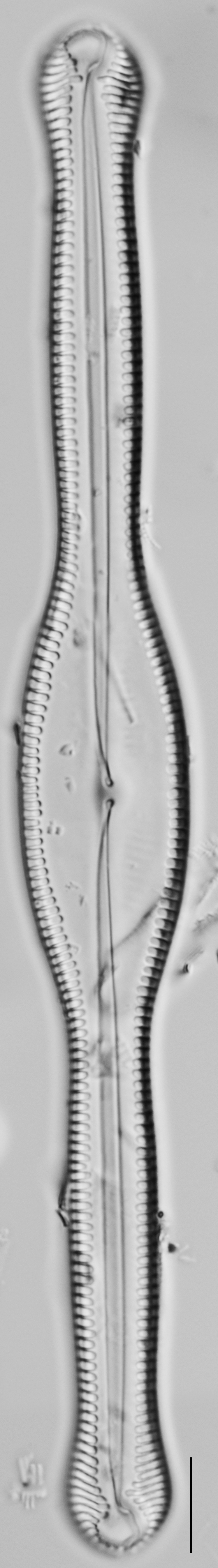 Pinnularia formica LM6