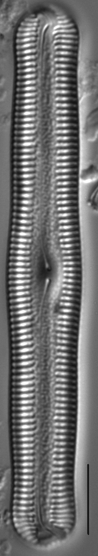 Pinnularia acrosphaeria LM6