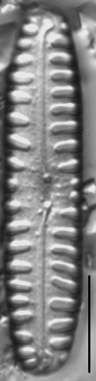 Pinnularia borealis LM6