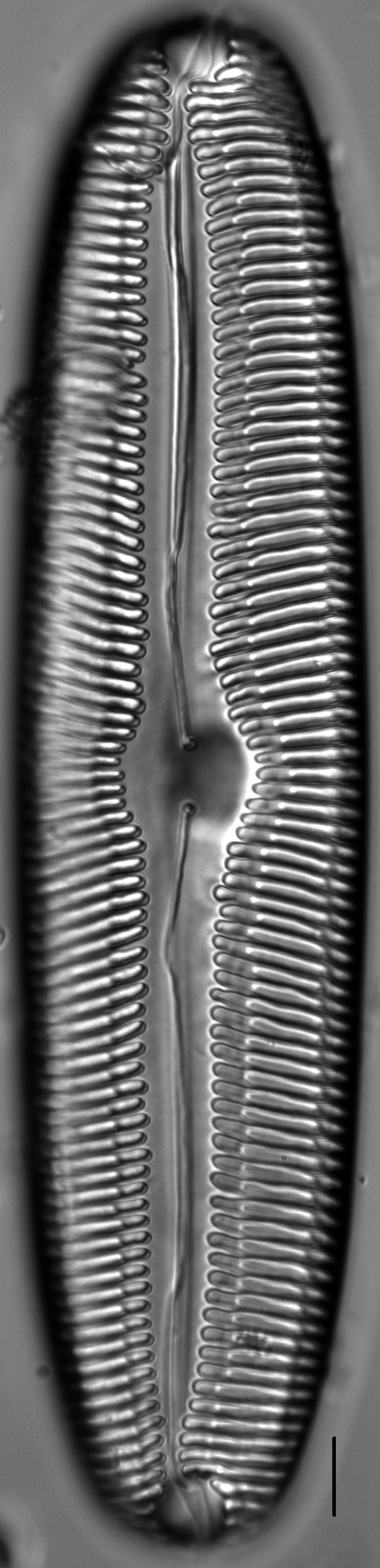 Pinnularia gigas LM4