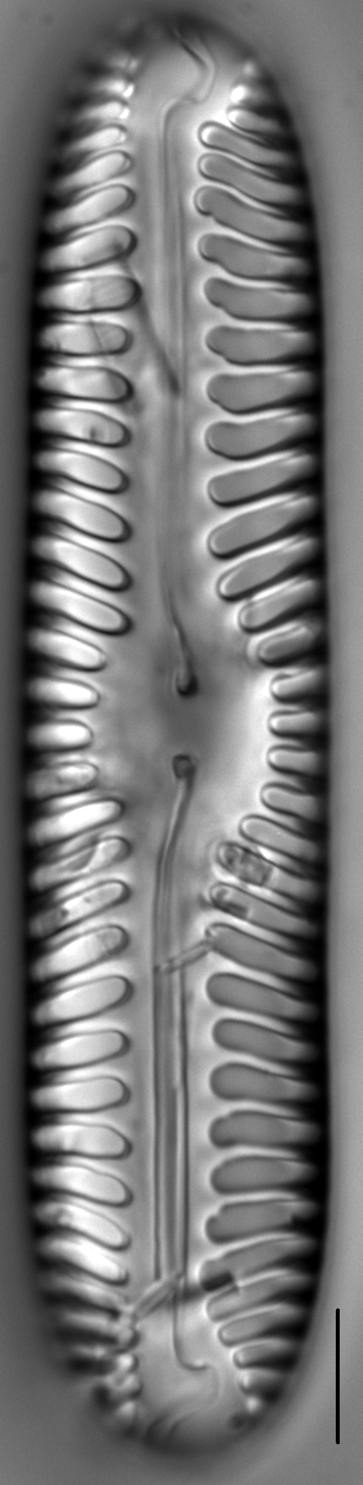 Pinnularia lata LM5