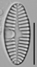 Planothidium Sheathii Lm05