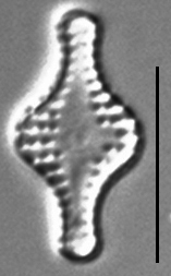 Pseudostaurosira pseudoconstruens LM6