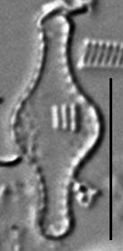 Pseudostaurosira pseudoconstruens LM4