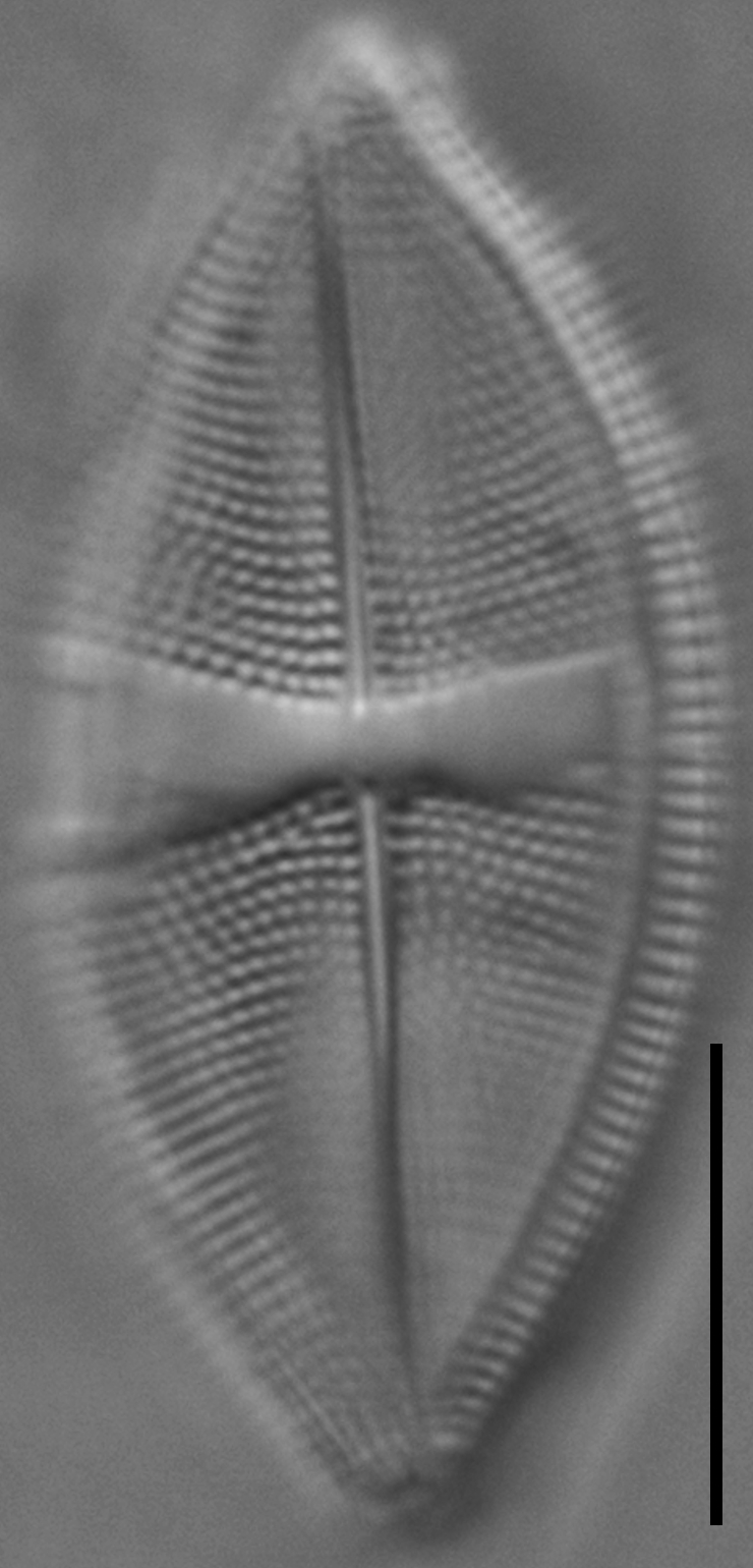 Psammothidium obliquum LM5